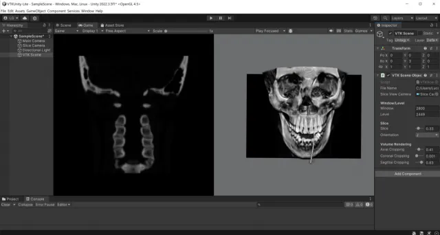 VTKUnity-MedicalVolumeViewer