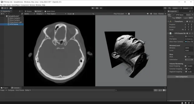 VTKUnity-MedicalVolumeViewer