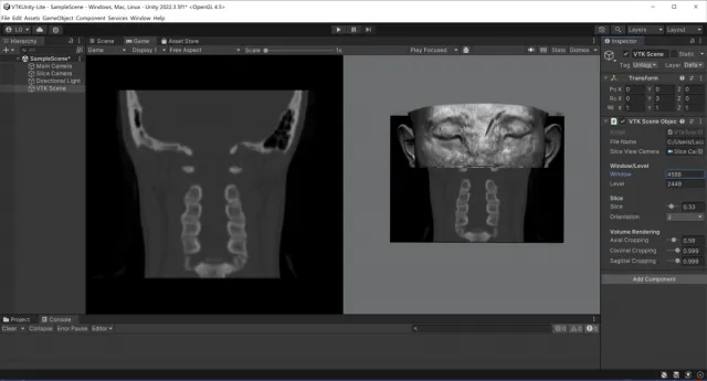 VTKUnity-MedicalVolumeViewer